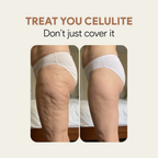 Avelin FormLift™ 3D Cellulite Leggings